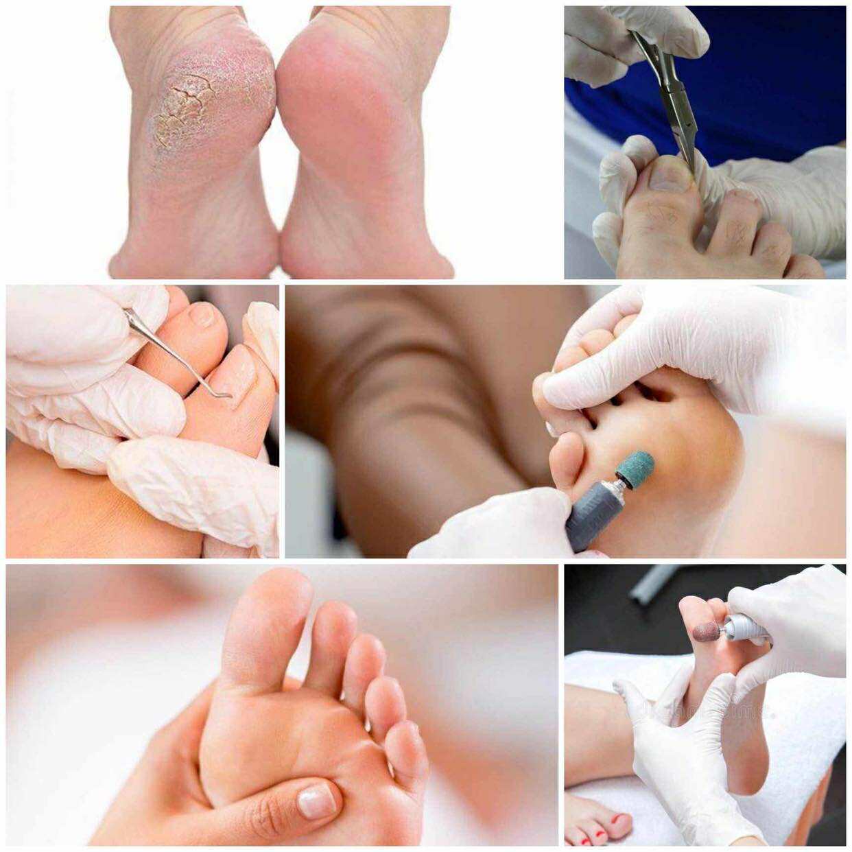 Σεμινάριο Ποδολογίας – Θεραπευτικό Πεντικιούρ / English Version